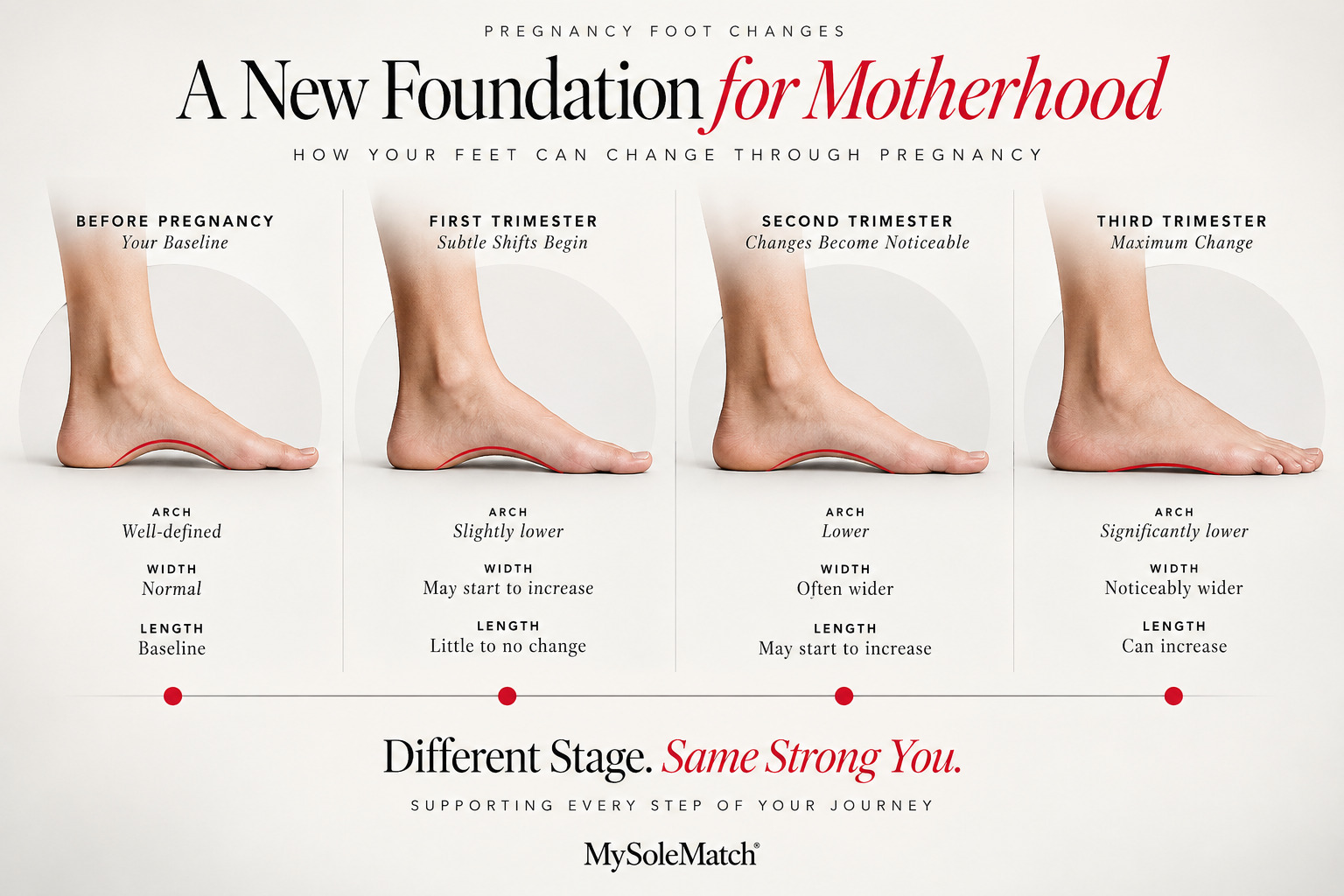 Four stage foot outline timeline showing early pregnancy, mid pregnancy, late pregnancy, and postpartum, with measurement callouts for length, width, and arch height